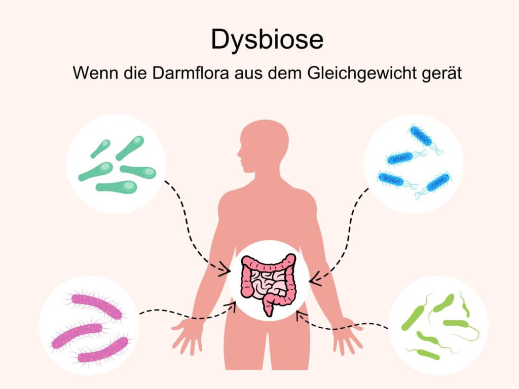 Dysbiose, Darmflora im Ungleichgewicht - © Canva
